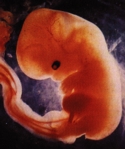 06week-sm